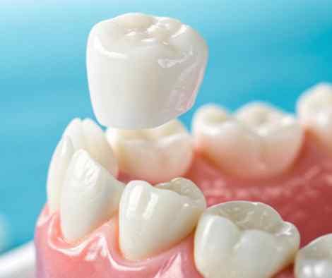Close-up of a dental exam showing a cracked tooth being assessed with a mirror and probe.