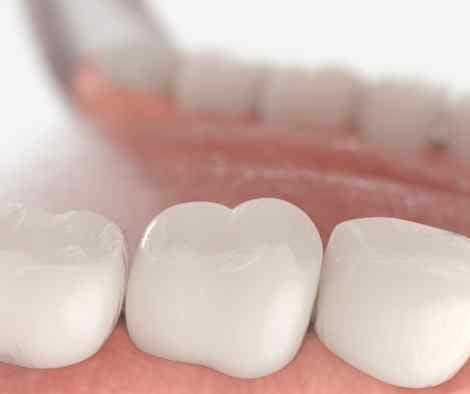 Image showing a tooth being cleaned