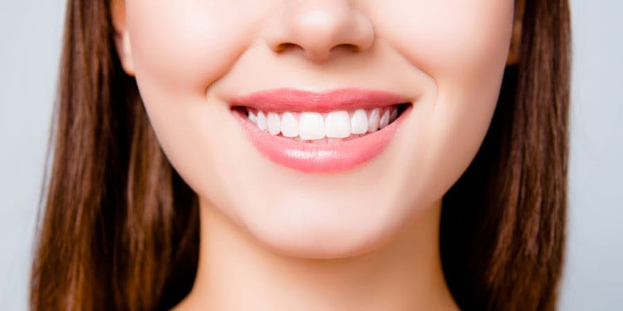 Dental Fillings Mississauga