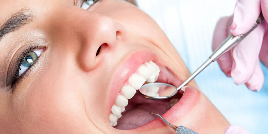 Dental Scaling & Root Planing Mississauga