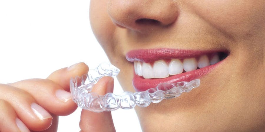 Invisalign Mississauga