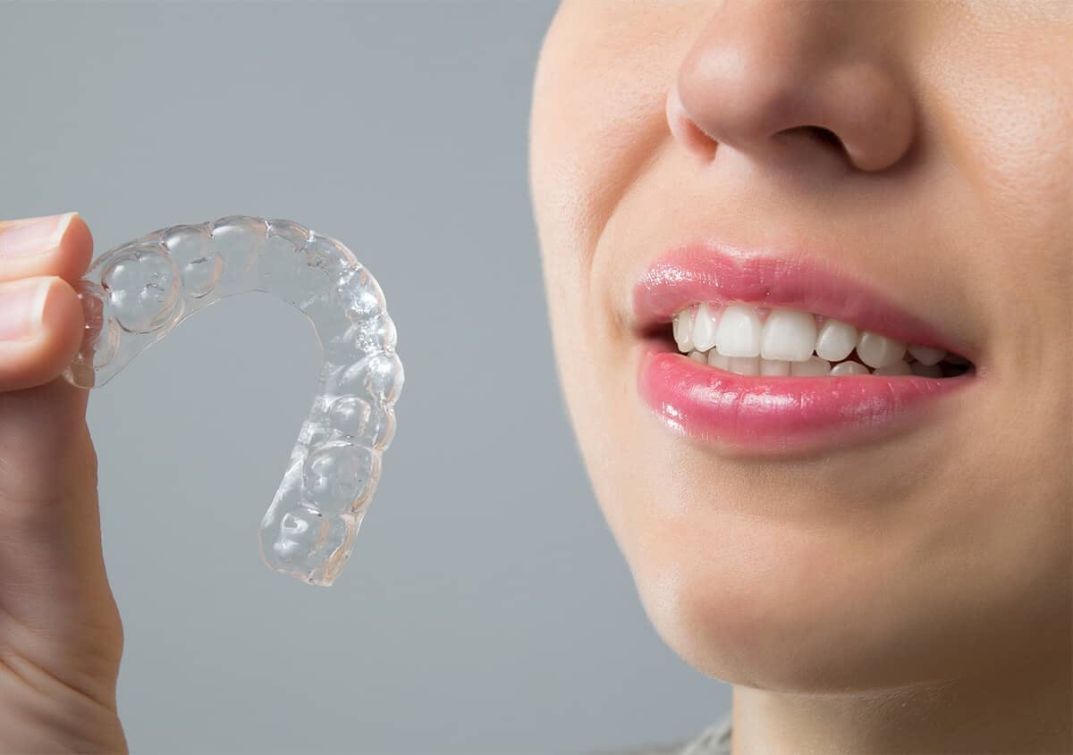 Faster, Subtle, and Comfortable Teeth Straightening with Invisalign