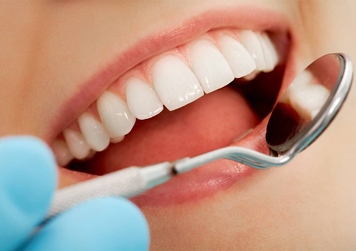 Professional Teeth whitening helps you live your best life through a white and beautiful smile!