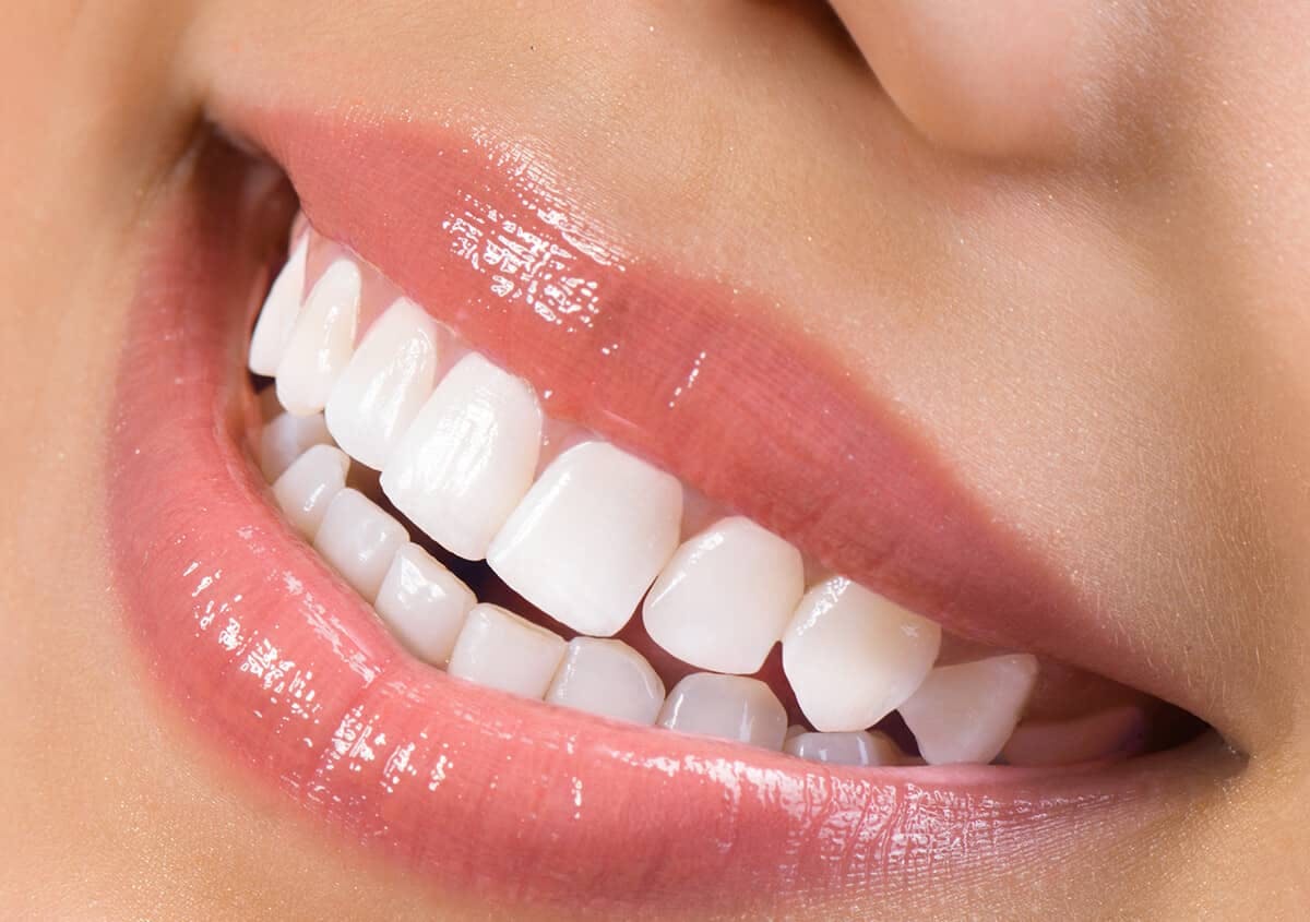 Transform your smile with our teeth whitening services